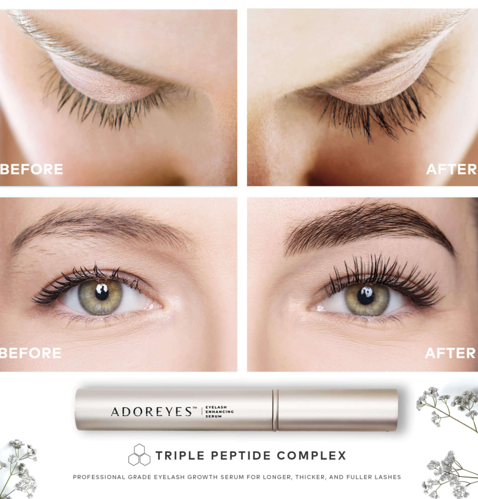 ADOREYES Before After