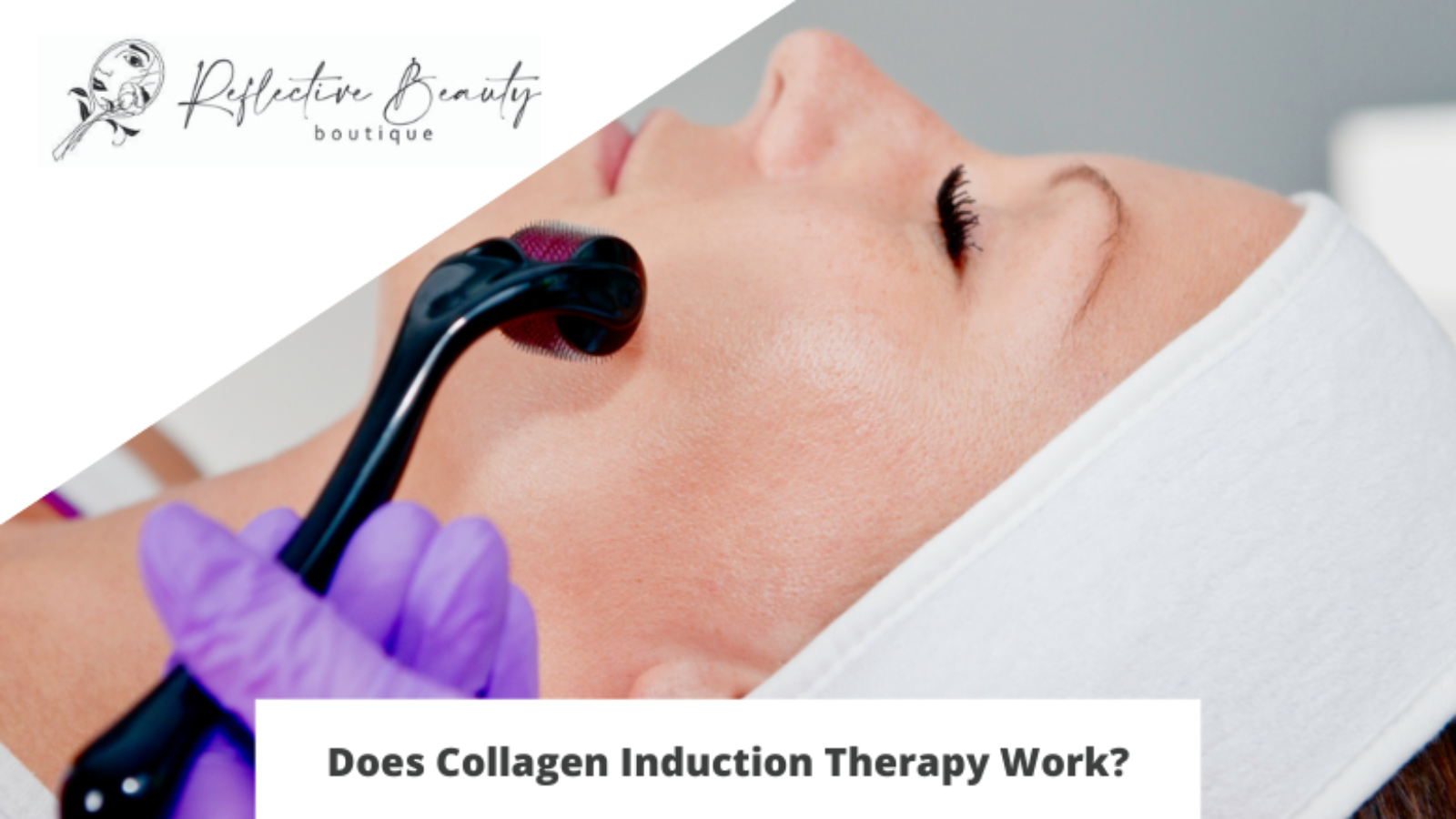 Does Collagen Induction Therapy Work